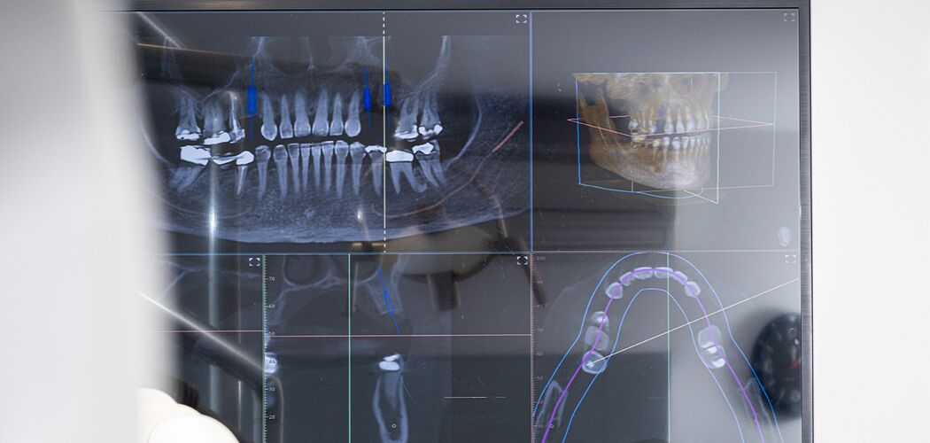 Digitales Röntgen/ DVT bei Dr. Peter Sporer